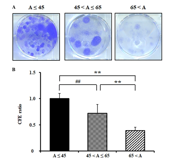 لایه‌های سلول های بنیادی اپیتلیال لیمبال اهداکنندگان جوان پتانسیل بازسازی بهتری دارند